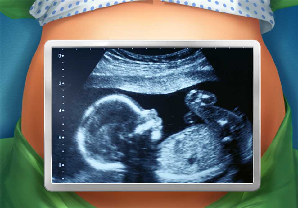 医院手术时间截图2